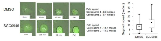 DOT1L 결핍시 빠른 centrosome 이동