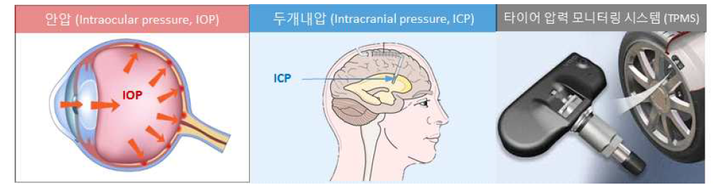 대표적인 압력 모니터링 시스템: 의료 및 자동차 분야