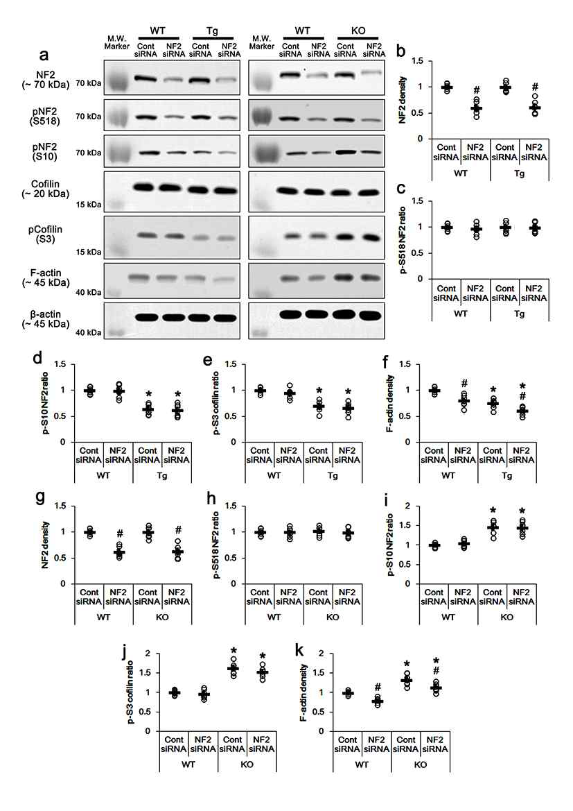 Effects of NF2 knockdown on NF2 and cofilin phosphorylations in PLPP/CINTg and PLPP/CIN-/- mice under physiological condition. (a) Representative western blots of NF2, pNF2-S10, pNF2-S518, cofilin, pCofilin-S3 and F-actin. (b-k) Quantification of NF2, pNF2-S10, pNF2-S518, cofilin, pCofilin-S3 and F-actin levels based on western blot data. Open circles indicate each individual value. Horizontal bars indicate mean value (*,#p < 0.05 vs. WT and control siRNA-treated animals, respectively; n = 7)