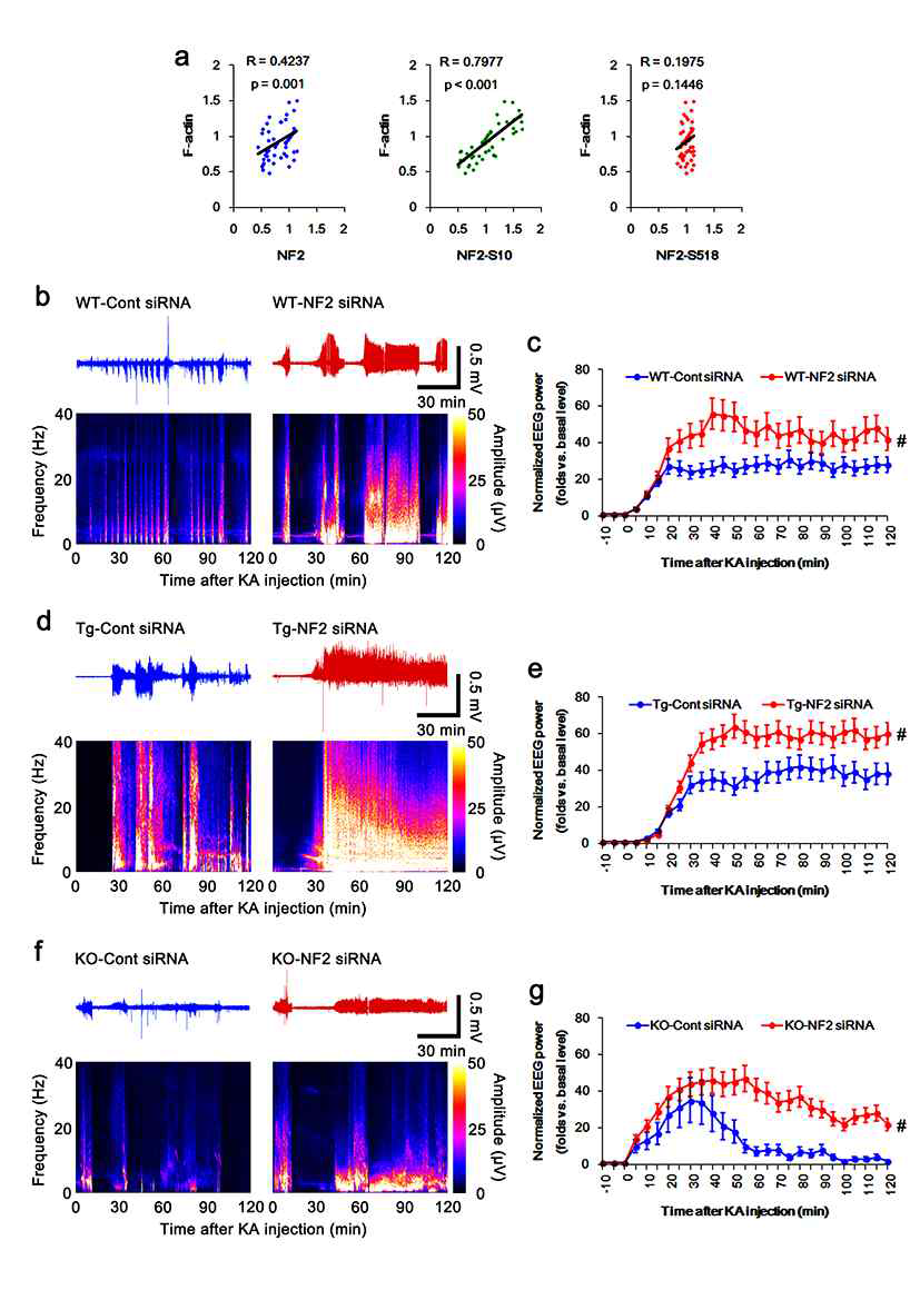 Linear regression analysis between NF2 expression and F-actin contents and the effects of NF2 knockdown on seizure activity in response to KA in PLPP/CINTg and PLPP/CIN-/- mice. (a) Linear regression analysis between NF2 expression and F-actin contents within control siRNA- and NF2 siRNA-treated groups of WT, PLPP/CINTg and PLPP/CIN-/- mice under physiological conditions. (b-g) Representative EEG traces and frequency-power spectral temporal maps (b, d and f) and quantification of total EEG power (seizure intensity) in response to KA (c, e and g) in WT (b-c), PLPP/CINTgPLPP/CIN-/- mice (#p < 0.05 vs. control siRNA-treated animals; n = 7, respectively)