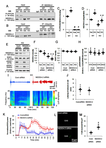 Effect of PLPP/CIN deletion on NEDD4-2 ubiquitination, and that of NEDD4-2 knockdown on seizure activity in response to KA in PLPP/CIN-/-mice. (A-D) Effect of PLPP/CIN-NEDD4-2 binding on NEDD4-2 ubiquitination following KA injection. (E-H)Effects of NEDD4-2 knockdown on NEDD4-2 expression, and SGK1expression/phosphorylation in response to KAinPLPP/CIN-/-mice. (I-K) Effects of NEDD4-2 knockdown on seizure activity in response to KA in PLPP/CIN-/-mice. (L-M) The effect of NEDD4-2 knockdown on KA-induced neuronal death in PLPP/CIN-/-mice