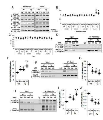 Effects of PLPP/CIN over-expression on surface KCNQ and GluA1 expression, GluA1-NEDD4-2 bindings and GluA1 ubiquitination. (A-C) Effects of PLPP/CIN over-expression on surface KCNQ and GluA1 expression following KA injection. (D-E) Effects of PLPP/CIN over-expressionon PLPP/CIN-NEDD4-2bindings. (F-G) Effects of PLPP/CIN over-expressionon GluA1-NEDD4-2binding. (H-J) Effects of PLPP/CIN over-expression on NEDD4-2 and GluA1 ubiquitinations