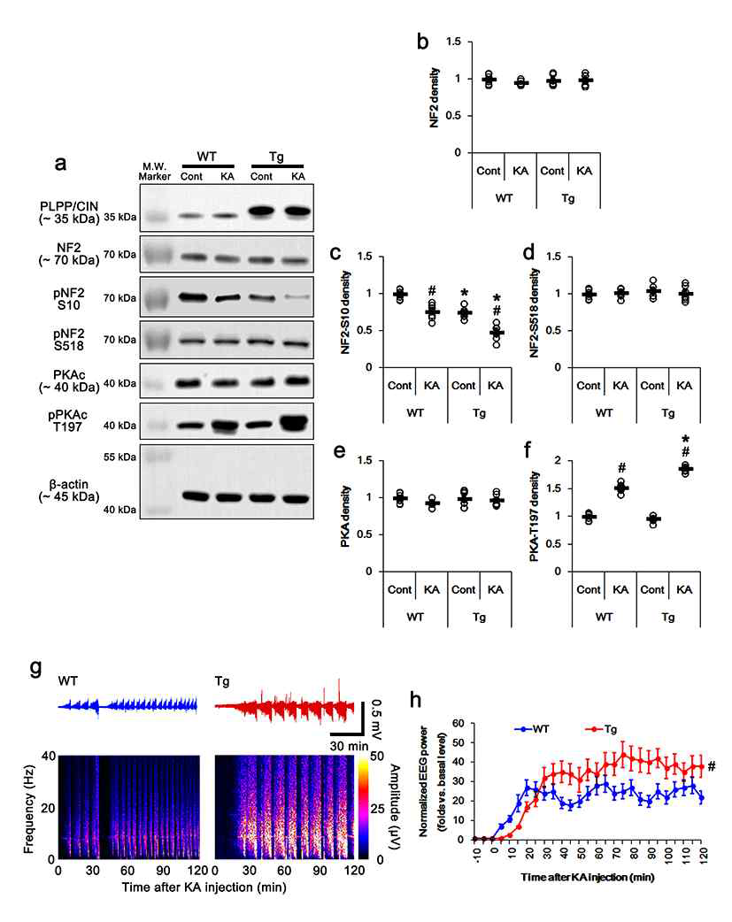 PLPP/CIN-mediated NF2 dephosphorylation. (a-e) In vitro assay using recombinant proteins. (a) Representative western blot data demonstrating PLPP/CIN-mediated NF2 dephosphorylation. (b-c) Quantification of NF2-S10 (b) and -518 (c) phosphorylation levels based on western blot data. Open circles indicate each individual value. Horizontal bars indicate mean value (*p < 0.05 vs. the presence of PLPP/CIN and PKAc; n = 7). (d) Representative co-immunoprecipitation data demonstrating PLPP/CIN-NF2 and -PKAc bindings. (e) Quantification of PLPP/CIN-NF2 and -PKAc bindings. Open circles indicate each individual value. Horizontal bars indicate mean value (*p < 0.05 vs. the presence of PLPP/CIN and PKAc; n = 7). (f-g) Effects of KA on PLPP/CIN-NF2 and -PKAc bindings in WT and PLPP/CINTg mice in vivo. (f) Representative co-immunoprecipitation data demonstrating PLPP/CIN-PKAc and NF2 bindings. (g) Quantification of PLPP/CIN-PKAc and -NF2 bindings. Open circles indicate each individual value. Horizontal bars indicate mean value (*,#p < 0.05 vs. WT and control animals, respectively; n = 7)