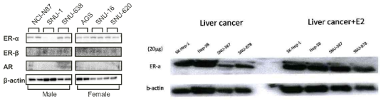 Expression change of sex hormone receptors by E2 (L; gastric cancer, R; liver cancer)
