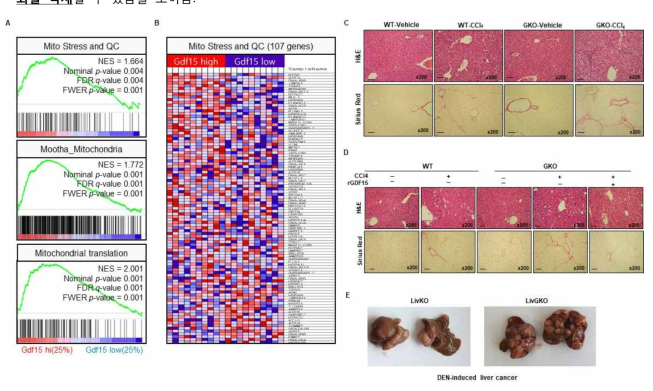 미토콘드리아 스트레스에 의한 GDF15의 증가와 GDF15 결손에 따른 간섬유화 및 간암 악화