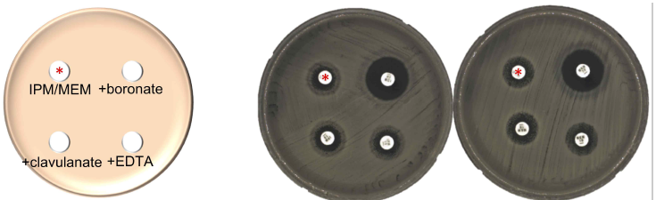 Enlarged inhibition zone around the carbapenem disks by supplementing boronic acid