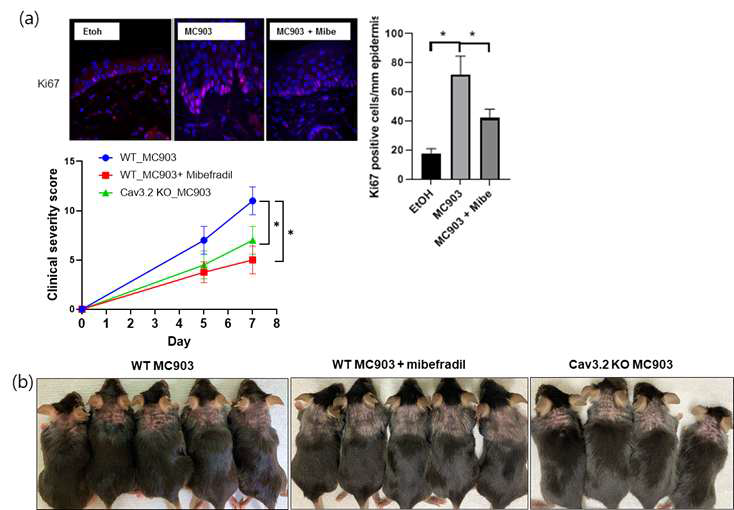 (a) T-type calcium channel inhibitor, Mibefradil supresses Ki67 expression in MC903-induced atopic dermatitis mouse model. (b) Clinical skin severity scores