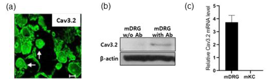 배양된 mouse DRG에서 면역형광염색 (a) 및 western blot (b)을 시행하여 T-type 칼슘채널 Cav3.2 의 단백 발현 확인. mouse keratinocyte에서는 T-type 칼슘채널 Cav3.2 mRNA가 detection 되지 않으나, mouse DRG에서 Cav3.2 mRNA가 detection 됨을 qPCR 로 확인함
