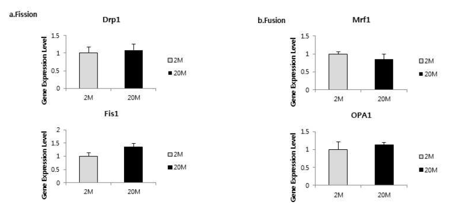 노화성 난청의 와우에서 mitochondrial fusion, fission factor 의 변화