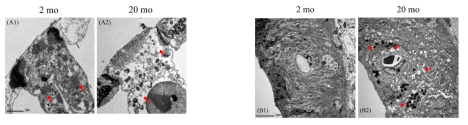 노화성 난청의 유모세포와 와우측벽의 mitochondria 손상