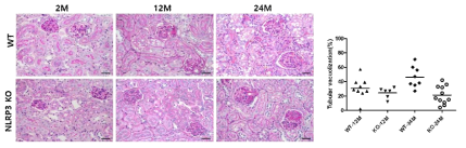 NLRP3 KO 쥐 신장에서 세뇨관 손상 변화