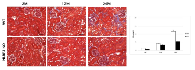 NLRP3 KO 쥐 신장에서 신장 섬유화 비교