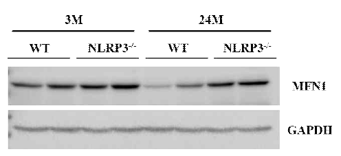 노화된 쥐의 신장 조직에서 NLRP3 차단에 의한 미토콘드리아의 변화