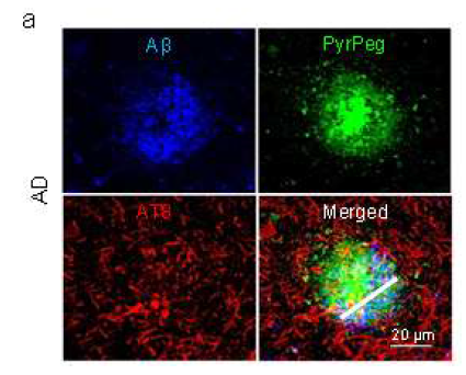OPM images of the normal and AD patient’s brain sections costained with an anti-Aβ antibody (blue), anti-phospho-tau antibody (AT8; red), and PyrPeg (green) and a merged image