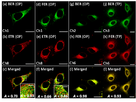 OPM and TPM images of HeLa cells colabeled with BER-blue and ETR (a,b), FER-green and ETR (d,e), and BER-blue and FER-green (g,h), and BER-blue and FER-green (j,k). The images were captured in the indicated channels upon excitation at 405 nm (a,d,g,h), 555 nm (b,e), and 750 nm (j,k). (c,f i,l) Merged images. A is Pearson’s colocalization coefficient. Representative images from replicate experiments are shown (n = 5). Scale bar: 20 μm