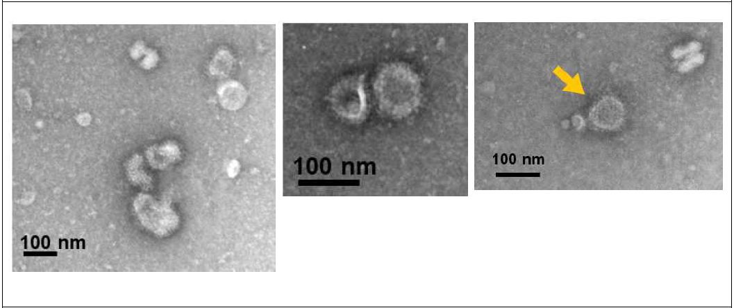 VLPs 의 전자현미경 이미지 VLPs는 influenza M1에 의한 원형의 몸체를 가지고 몸체의 표면에 말라리아 항원 단백이 스파이크의 형태로 배치되어 있음. 백신을 TEM으로 확인하였을 때 원형의 particle 표면에 수많은 돌기가 보임. 이것으로 미루어 보아 말라리아 원충의 항원 단백을 포함하는 VLPs 백신이 정상적으로 생성된 것을 알 수 있음