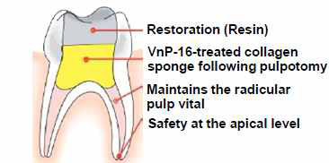 Schematic diagram for evaluating the effect of VnP-16 on reparative dentin formation in a rat pulpotomy model