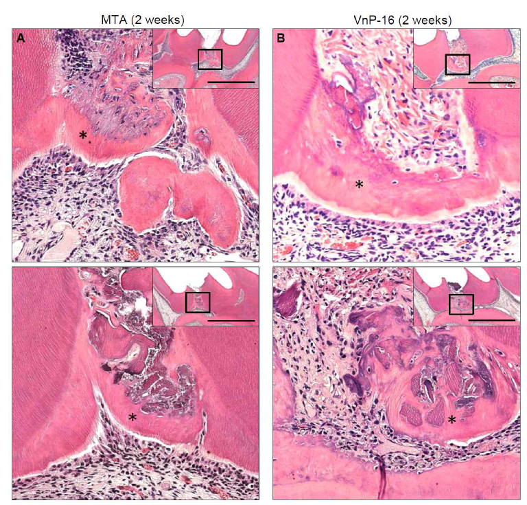 Dentin bridge formation in rat mandibular first molar at 14 days after direct pulp capping with MTA and VnP-16. (A, B) Representative photomicrographs showing a dentin-like matrix (*) in the mandibular first molars of rats 14 days after direct pulp capping with MTA (A) or VnP-16 peptide (B), appearing as tubular structure lined with odontoblast-like cells. Conditions of animal experiments were the same as described in the legend to Fig. 4C (A) and 4F (B). Rats were euthanized by inhaling carbon dioxide, and mandibular specimens containing the first molars were obtained. After demineralizing the mandibular specimens, H&E staining was performed. Photomicrographs are magnified images of the rectangles shown in the upper right