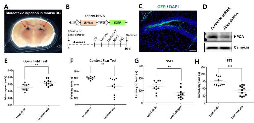 마우스 해마의 dentate gyrus부위에 Hippocalcin을 억제시키면 인지기능의 저하 및 우울감과 불안증상을 보임