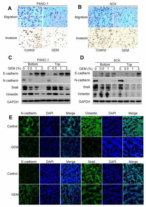 Gemcitabine에 의한 췌장암 및 담도암세포의 migration 및 EMT 대사기전 분석
