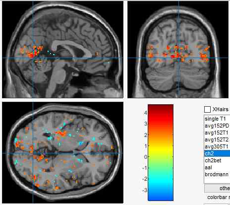 의식적 지각의 fMRI 결과