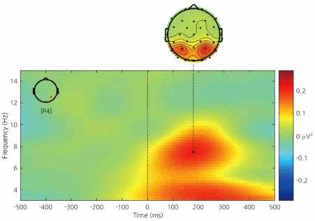 뇌파의 시간-주파수 분석