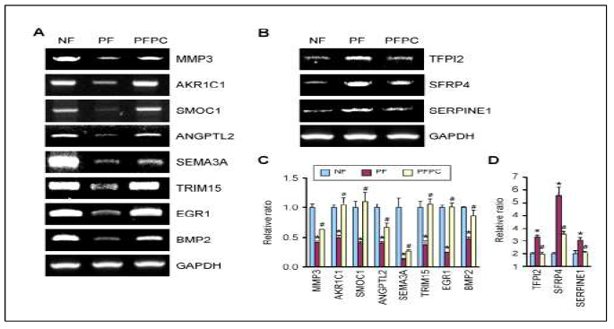 RT-PCR을 통한 RNA sequencing 결과의 검증 (NF: 정상 섬유아세포; PF :PD 유래 섬유아세포; PFPC: PC-NVs 처리된 PD 유래 섬유아 세포)