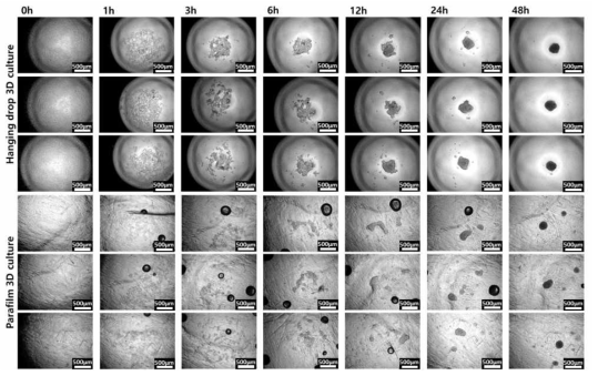 Hanging drop (HD) 및 parafilm method (MP) 방법을 사용하여 생성된 hDPSC 3D 스페로이드의 시간에 따른 형상 분석 이미지