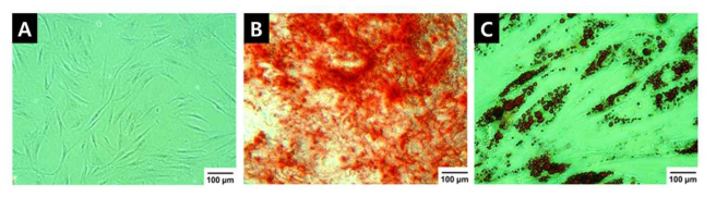 지방유래 줄기세포의 2가지 분화 후 염색을 통한 분화 확인 과정. (A) 분화하지 않은 MSC (B) ARS 염색을 통한 뼈세포 분화 확인. (C) Oil Red O 염색을 통한 지방세포 분화 확인