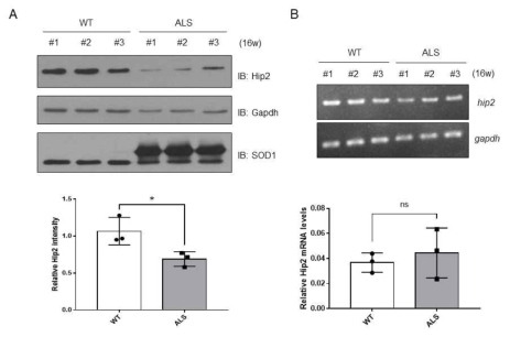 ALS 형질전환 mouse에서 hip2의 단백질과 mRNA양 비교