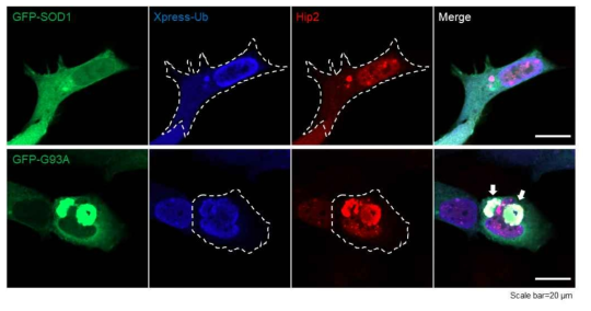 SOD1과 hip2 그리고 ubiquitin의 co-localization 여부 검증