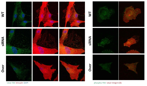 ITGBL1의 발현을 저해할 경우 Trailing edge 특이적으로 인테그린의 활성이 증가함. 인테그린의 활성에 의해 Focal adhesion 마커인 FAK, Vinculin 등이 trailing edge에 증가되어 있음을 확인하였다