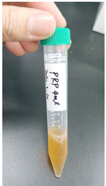 제조된 PRP