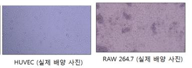 본 연구실에 배양된 실제 RAW 264.7 대식세포 및 HUVEC 혈관내피세포 이미지