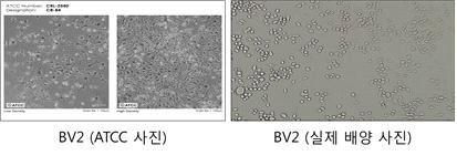 BV2 미세아교세포 이미지