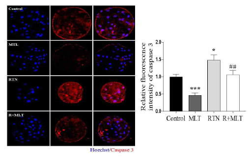 멜라토닌의 처리가 Caspase3의 발현을 억제하였음