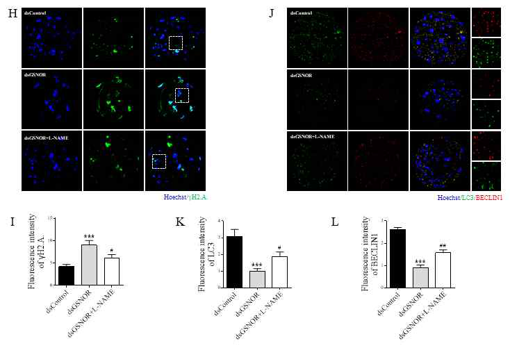 GSNOR이 KD 된 배반포에서 apoptosis와 autophagy 는 GSNOR을 KD 된 그룹에 비하여 부분적으로 회복되었음