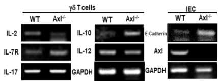 Axl에 의한 감마델타 T 전구 세포 내 유전자 발현 변화
