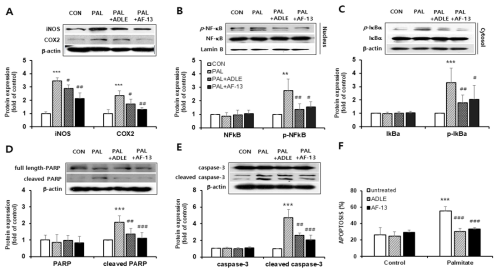 팔미테이트 유도 INS-1 세포에 대한 AF-13 화합물의 NFκB 활성화 변화,염증발현 및 세포 사멸에 미치는 영향