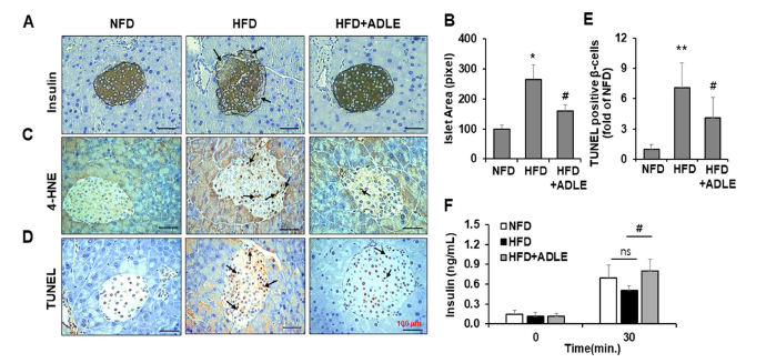 췌장에서 항산화, apoptosis 관련 단백질의 발현