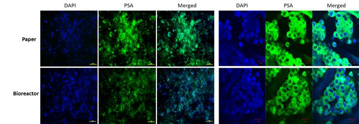각각 일반 한천배지 플레이트와 바이오리액터에서 배양된 LNCaP 세포에 대한 PSA 면역형광염색 결과 (DAPI: 파란색, PSA: 녹색)