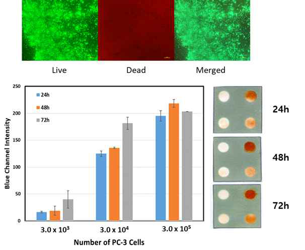 (위)종이에서 48시간 배양된 PC-3 세포 (3×104 cells)에 대한 Live/Dead 어세이의 형광 이미지, (아래) 종이에서 배양된 PC-3세포에 대해 WST 어세이 후 이미지와 비색분석결과