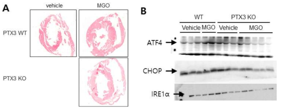 PTX3 deficiency protects from chronic MGO-induced cardiac hypertropy and ER stress