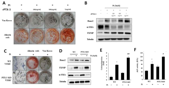 The role of PTX3 in vascular calcification