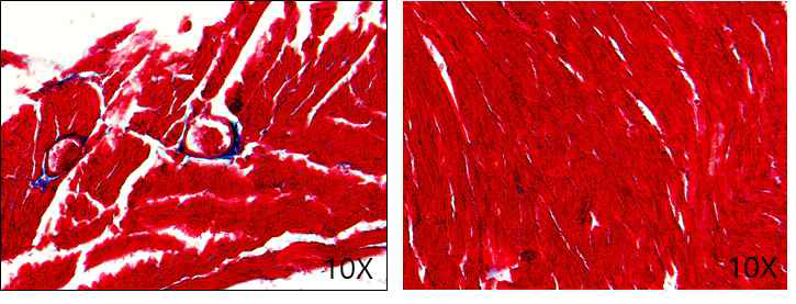 Trichrome stain in WT and PTX-3 KO