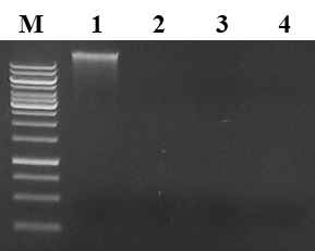 Agaroge gel을 이용한 DNA 분석(무처리구(1), NaOH(2), HCl(3), H2SO4(4))