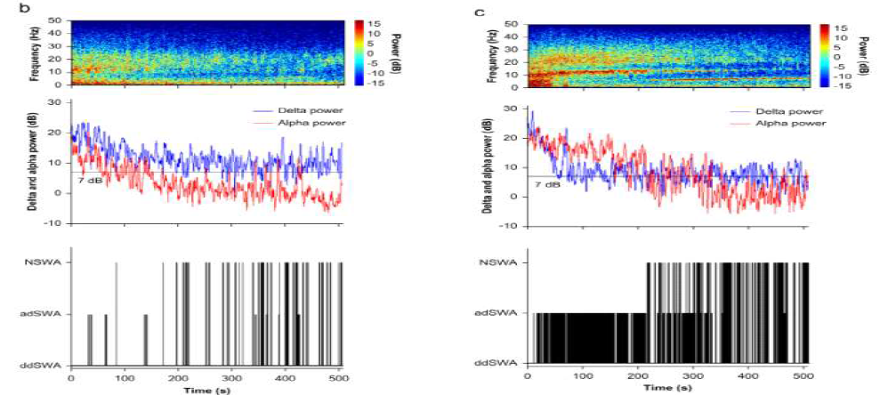 마취 각성기 소아 환자의 뇌파의 Spectrgram. 왼쪽은 각성 섬망이 발생한 환자의 뇌파에서 많이 보이는 패턴으로 delta wave의 영역 (1~4Hz)이 전반적으로 증가되어있는 가운데 우측은 정상 대조군의 뇌파로 delta wave 영역보다는 alpha wave (8 ~12 Hz)의 power가 증가되어 있는 것을 확인할 수 있다