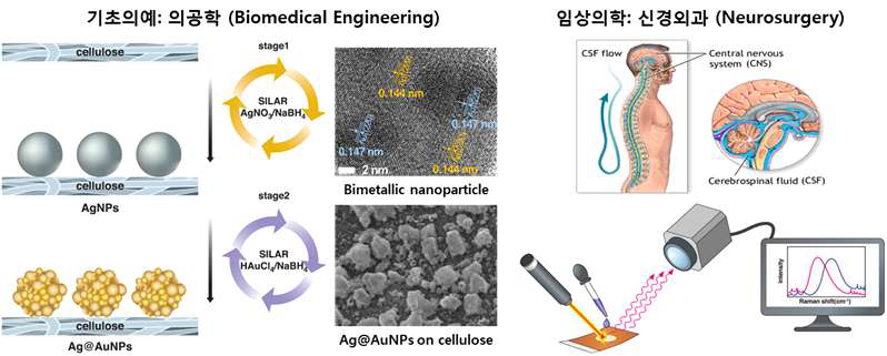 뇌척수액 기반의 무표지자 광-바이오 센싱 기술을 이용한 뇌질환의 조기 진단 및 예후 모니터링을 위한 방법에 관한 연구를 위한 기초학문과 임상의학의 융복합 연구의 개략도