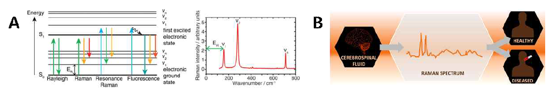 (A) 라만 산란 과정의 양자학적 이해와 (B) 뇌척수액에 의한 뇌질환 병변 라만 스펙트럼을 얻을 수 있는 개략도