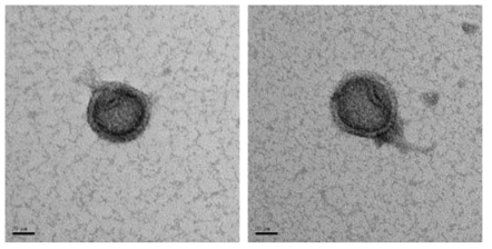 Celeribacter SJW1-2P 박테리오파지의 투과전자현미경 사진